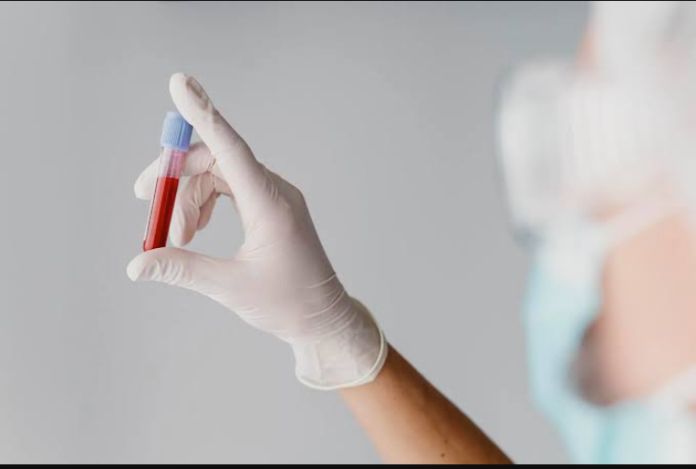 How to Know Your Blood Type Without Testing Safely