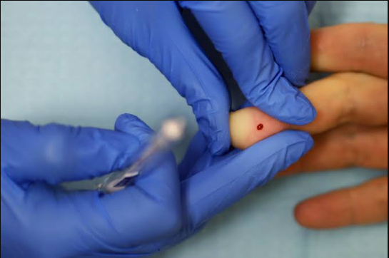 How to Know Your Blood Type Without Testing: Simple Guide