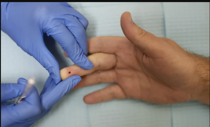 How to Know Your Blood Type Without Testing